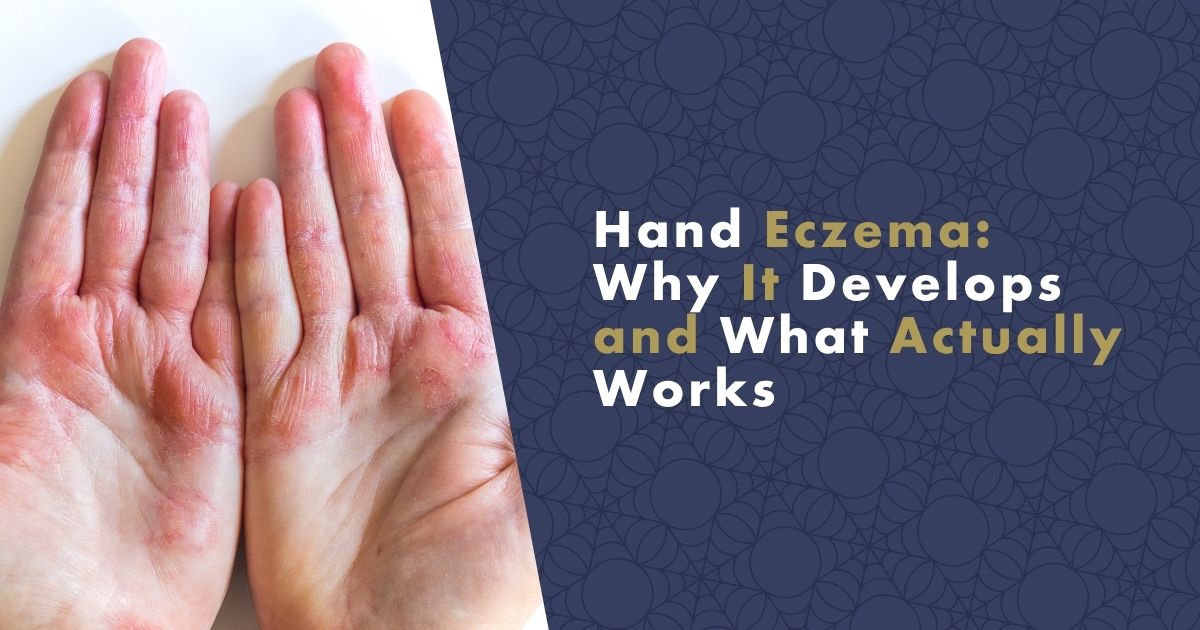 hand-eczema-fb (1)